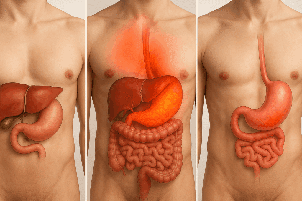Why Does My Stomach Hurt After I Eat? Understanding Common Causes of Abdominal Pain and How to Find Relief Naturally 4 Medical illustration comparing gallstones, pancreatitis, and peptic ulcers to explain why does my stomach hurt after I eat.